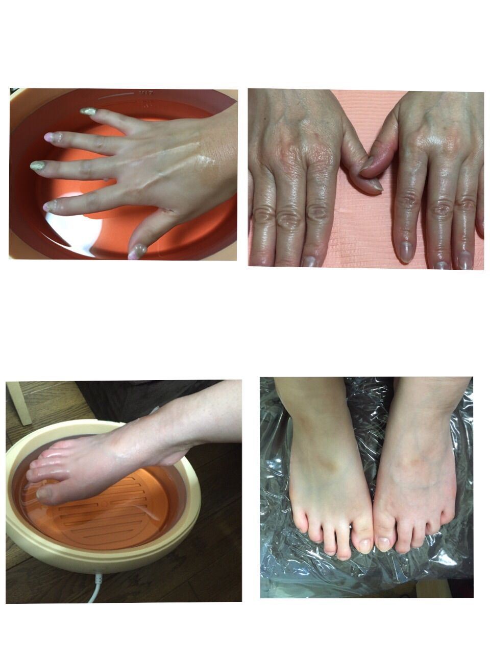 パラフィンパック